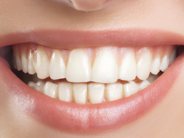Expert Dental Implants in Hyderabad: Restore Your Confidence Dental implant